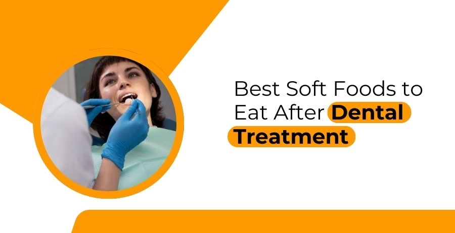 Best Soft Foods to Eat After Dental Treatment