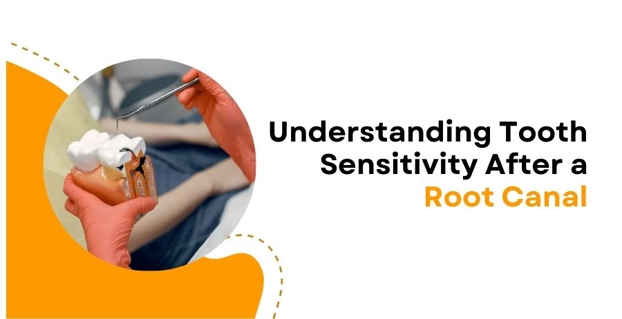 Understanding Tooth Sensitivity After a Root Canal